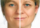  Envejecimiento facial: a cada edad un tratamiento